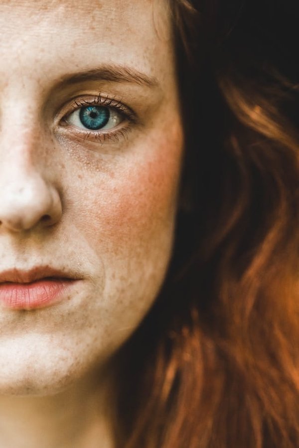 Astuces pour éviter la peau sèche en hiver